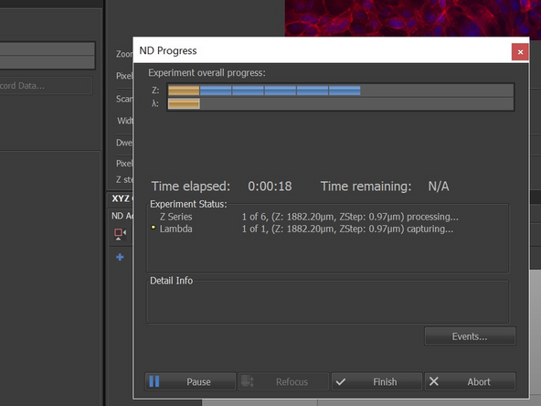 You can go Live and focus through your sample to set/adjust the z-stack boundaries (&quot;Bottom&quot; and &quot;Top&quot;).