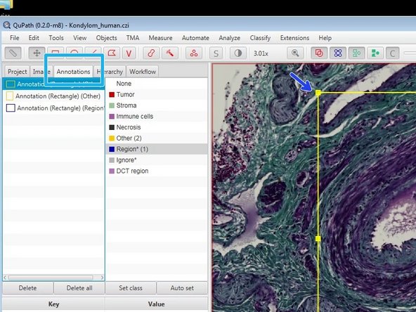 Draw a region of interest around the feature you would like to annotate.