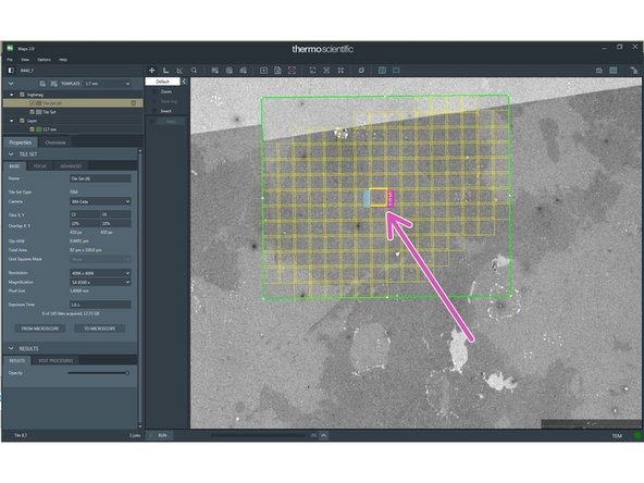 Press R1 on the right panel to insert the Flu screen (left screen)